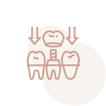 Implantes